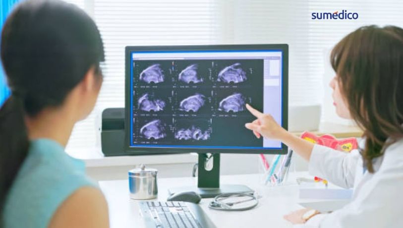 Cáncer de ovario: estar inflamada siempre no es normal