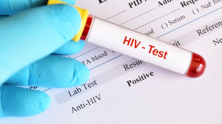 "Prevención combinada", la estrategia para frenar la transmisión del VIH