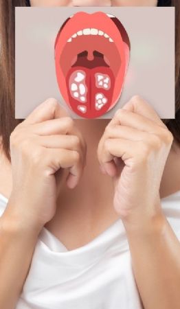 Foto descriptiva de: ¿Cuáles son las consecuencias de tener intimidad oral?