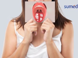 ¿Cuáles son las consecuencias de tener intimidad oral?