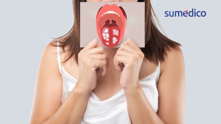 ¿Cuáles son las consecuencias de tener intimidad oral?