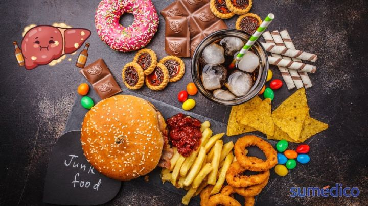 5 alimentos que dañan tu hígado