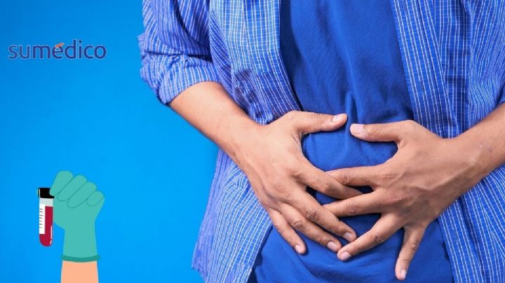 La nueva prueba para detectar el cáncer de colon, ¿en qué consiste?