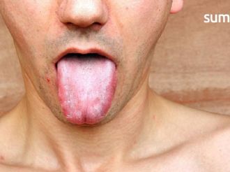 ¿Se te duerme la lengua? 5 enfermedades que podrían causarlo