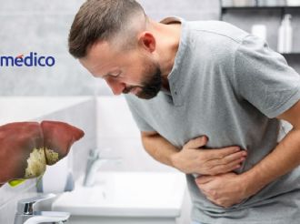 5 hábitos prohibidos si tienes hígado graso