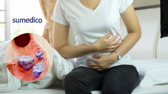 Así cambian las células del cáncer de colon para propagarse