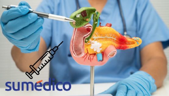 Crean una vacuna para “interceptar” el cáncer de páncreas en personas con alto riesgo