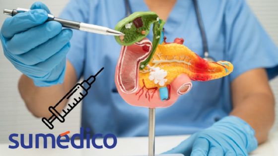 Crean una vacuna para “interceptar” el cáncer de páncreas en personas con alto riesgo