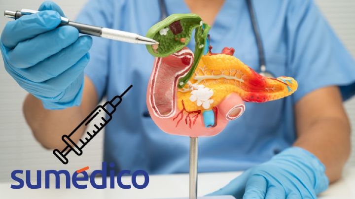 Crean una vacuna para “interceptar” el cáncer de páncreas en personas con alto riesgo