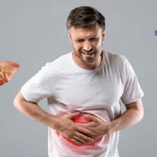 5 alimentos malos que debes prevenir si tienes hígado graso