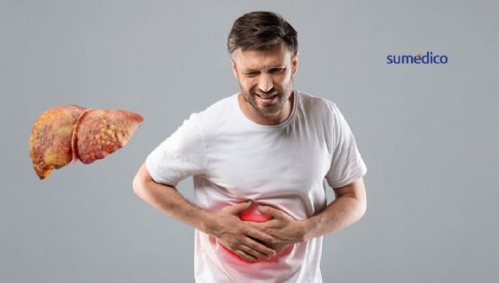 5 alimentos malos que debes prevenir si tienes hígado graso