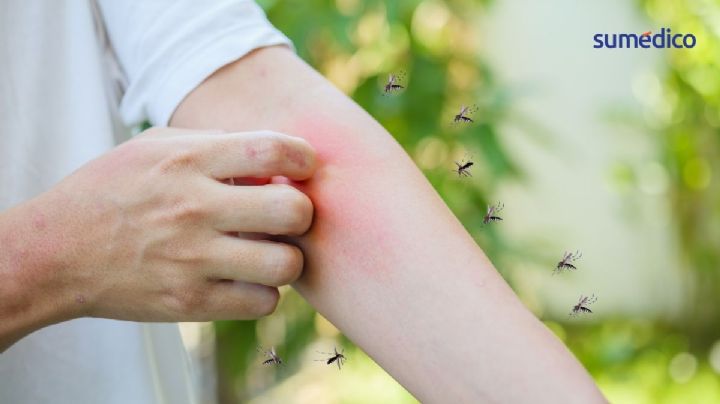 ¿Por qué los mosquitos te pican siempre a ti y no a los de tu alrededor?