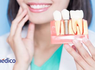 Salud dental: claves para una sonrisa fuerte y duradera