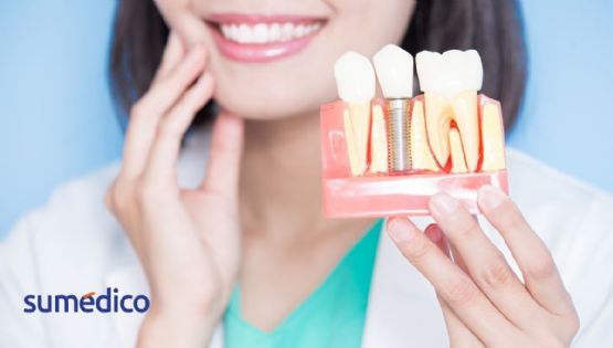 Salud dental: claves para una sonrisa fuerte y duradera