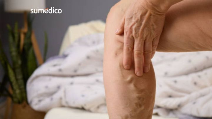 El síntoma en las piernas que muchos ignoran y puede ser mortal