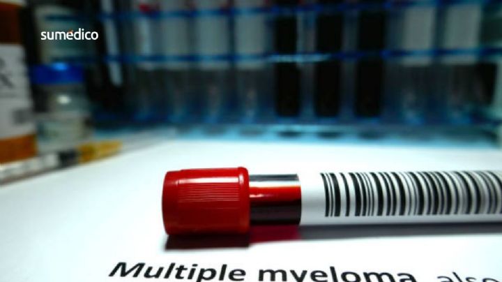 Bristol Myers abre nueva clase de tratamientos contra el mieloma múltiple