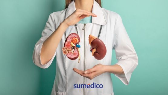 5 consejos para cuidar tus riñones
